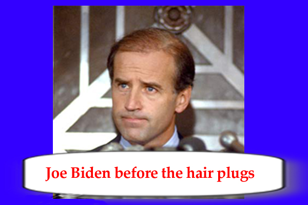 Joe Biden before the hair plugs
